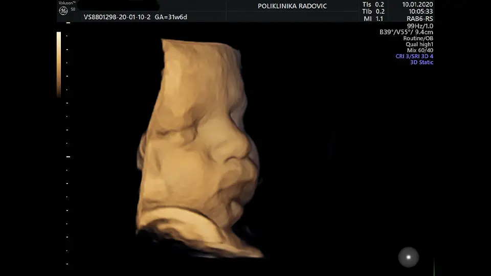 The place of 2D/3D/4D ultrasound in gynecology and obstetrics